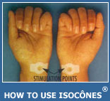 iso-cone demo on wrist