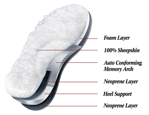 The slippers are arch support