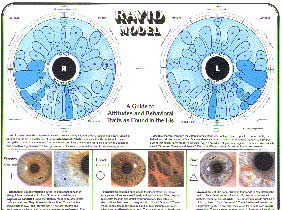 Rayid Iridology Chart