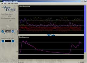 biofeedback